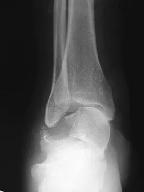 Foot & Ankle 2006 Practice Questions: Set 1 (Solved) - Figure 32