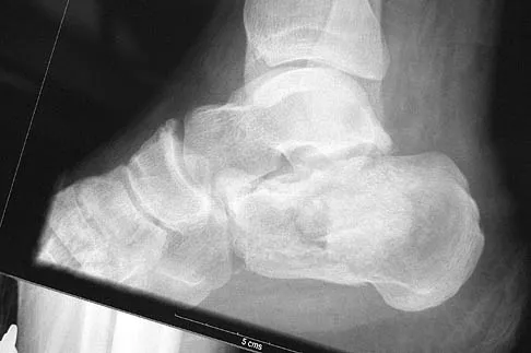 Foot & Ankle Board Review 2006: High-Yield MCQs (Set 2) - Figure 10