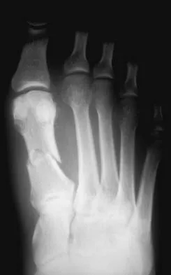 Foot & Ankle Board Review 2006: High-Yield MCQs (Set 2) - Figure 19