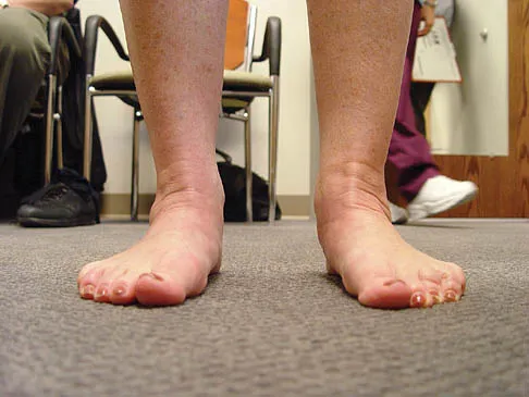 Foot & Ankle Board Review 2006: High-Yield MCQs (Set 2) - Figure 23