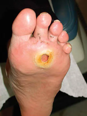 Click to enlarge Foot & Ankle Board Review 2006: High-Yield MCQs (Set 2) - Figure 29