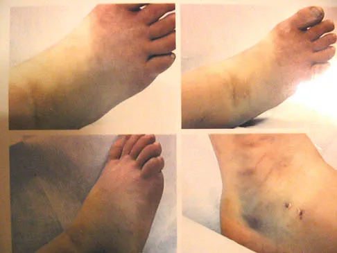 Foot & Ankle Board Review 2006: High-Yield MCQs (Set 2) - Figure 3