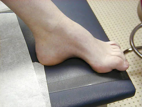 Foot & Ankle Board Review 2006: High-Yield MCQs (Set 2) - Figure 30