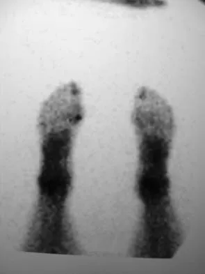 Foot & Ankle Board Review 2006: High-Yield MCQs (Set 2) - Figure 33