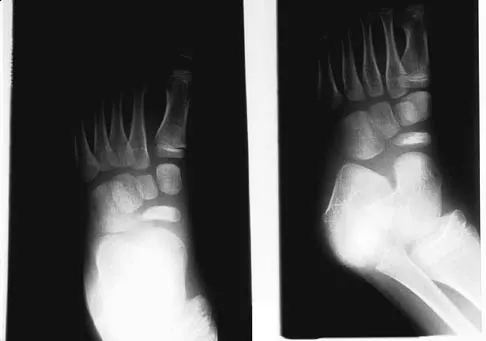 Foot & Ankle 2006 Practice Questions: Set 3 (Solved) - Figure 13