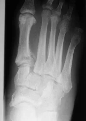 Click to enlarge Foot & Ankle 2006 Practice Questions: Set 3 (Solved) - Figure 3