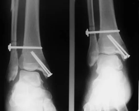 Foot & Ankle 2006 Practice Questions: Set 3 (Solved) - Figure 9