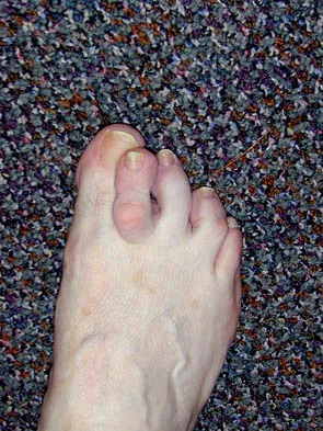 Foot & Ankle 2006 MCQs - Part 4