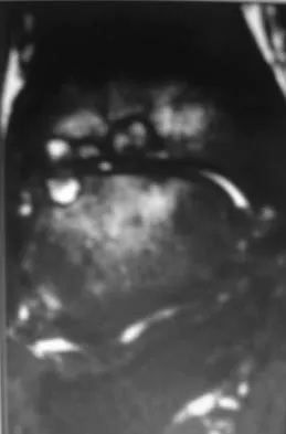 Foot & Ankle Board Review 2006: High-Yield MCQs (Set 4) - Figure 12