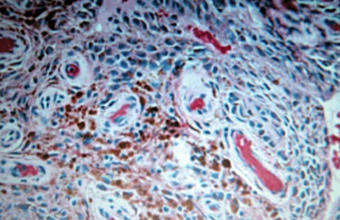 Foot & Ankle Board Review 2006: High-Yield MCQs (Set 4) - Figure 14