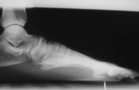 Foot & Ankle Board Review 2006: High-Yield MCQs (Set 4) - Figure 16