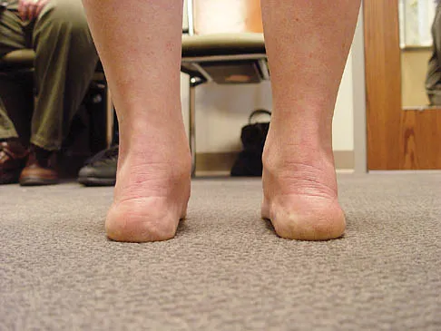 Foot & Ankle Board Review 2006: High-Yield MCQs (Set 4) - Figure 19