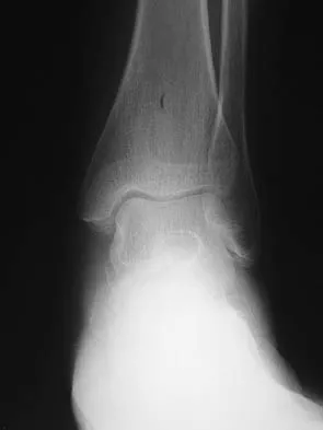 Foot & Ankle Board Review 2006: High-Yield MCQs (Set 4) - Figure 21