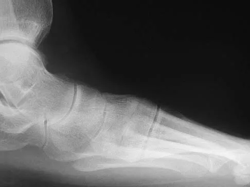 Foot & Ankle Board Review 2006: High-Yield MCQs (Set 4) - Figure 22