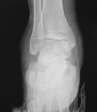 Foot & Ankle Board Review 2006: High-Yield MCQs (Set 4) - Figure 4