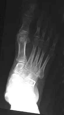 Foot & Ankle 2009 Practice Questions: Set 1 (Solved) - Figure 10