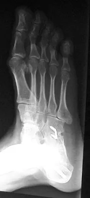 Foot & Ankle 2009 Practice Questions: Set 1 (Solved) - Figure 11