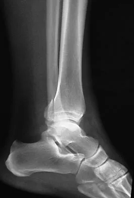 Foot & Ankle 2009 Practice Questions: Set 1 (Solved) - Figure 19