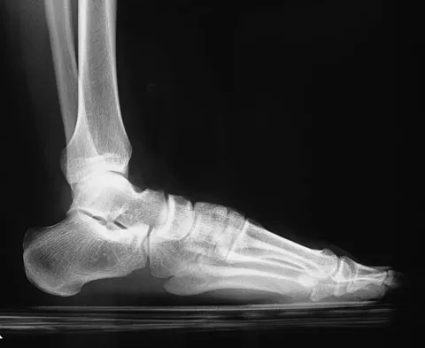 Foot & Ankle 2009 Practice Questions: Set 1 (Solved) - Figure 23