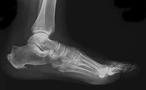 Foot & Ankle 2009 Practice Questions: Set 1 (Solved) - Figure 27