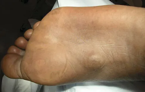 Foot & Ankle 2009 Practice Questions: Set 1 (Solved) - Figure 28