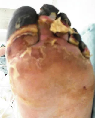 Foot & Ankle 2009 Practice Questions: Set 1 (Solved) - Figure 34