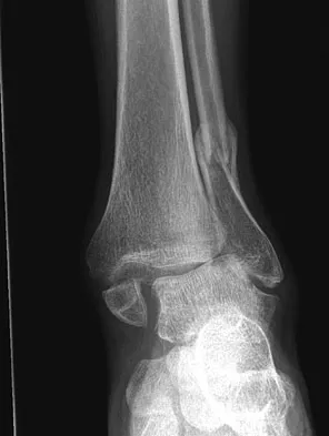 Foot & Ankle 2009 Practice Questions: Set 1 (Solved) - Figure 36