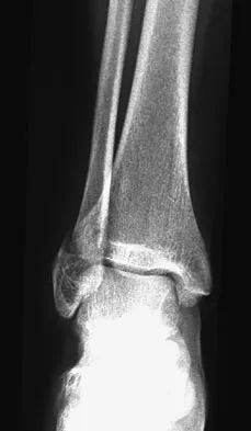 Foot & Ankle 2009 Practice Questions: Set 1 (Solved) - Figure 5