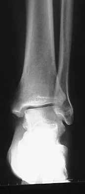 Foot & Ankle 2009 Practice Questions: Set 1 (Solved) - Figure 6