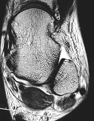 Foot & Ankle Board Review 2009: High-Yield MCQs (Set 2) - Figure 13