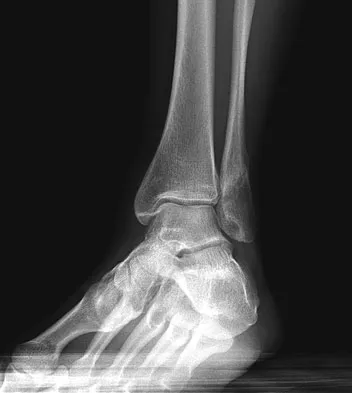 Foot & Ankle Board Review 2009: High-Yield MCQs (Set 2) - Figure 14