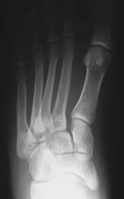 Foot & Ankle Board Review 2009: High-Yield MCQs (Set 2) - Figure 16