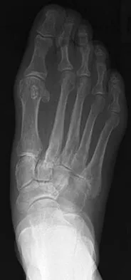 Foot & Ankle Board Review 2009: High-Yield MCQs (Set 2) - Figure 21