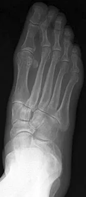 Foot & Ankle Board Review 2009: High-Yield MCQs (Set 2) - Figure 22