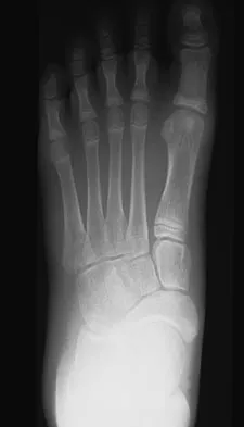 Foot & Ankle Board Review 2009: High-Yield MCQs (Set 2) - Figure 25