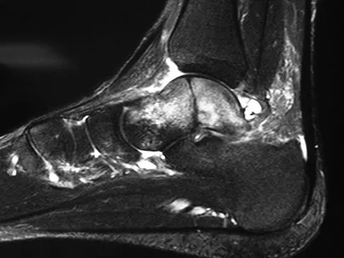 Foot & Ankle Board Review 2009: High-Yield MCQs (Set 2) - Figure 5