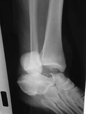 Foot & Ankle Board Review 2009: High-Yield MCQs (Set 2) - Figure 7