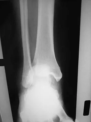 Foot & Ankle Board Review 2009: High-Yield MCQs (Set 2) - Figure 8
