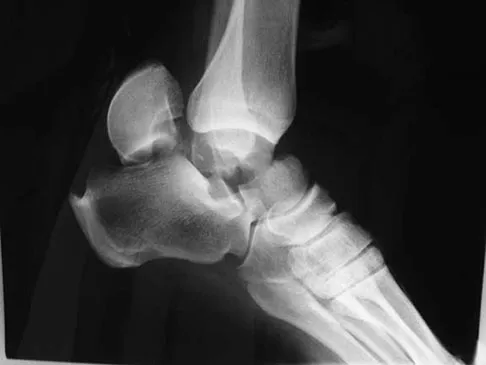 Foot & Ankle Board Review 2009: High-Yield MCQs (Set 2) - Figure 9