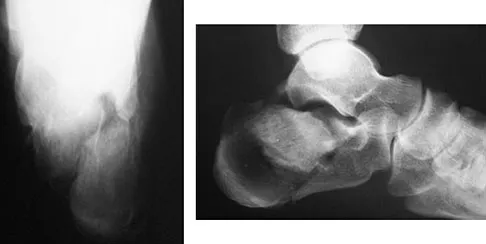 Foot & Ankle 2009 Practice Questions: Set 3 (Solved) - Figure 11