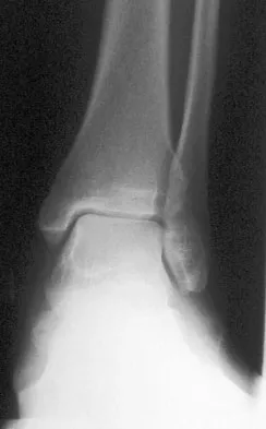 Foot & Ankle 2009 Practice Questions: Set 3 (Solved) - Figure 12