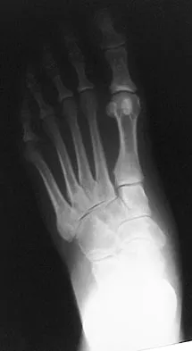 Foot & Ankle 2009 Practice Questions: Set 3 (Solved) - Figure 13