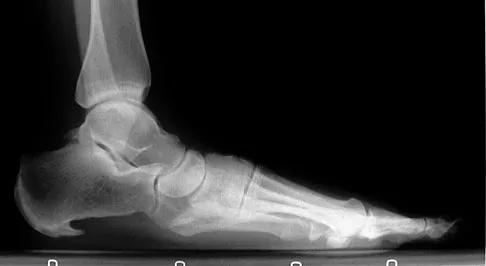 Foot & Ankle 2009 Practice Questions: Set 3 (Solved) - Figure 14