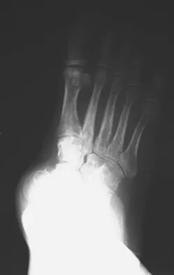 Foot & Ankle 2009 Practice Questions: Set 3 (Solved) - Figure 5