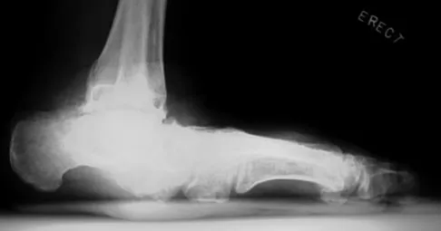 Foot & Ankle 2009 Practice Questions: Set 3 (Solved) - Figure 6