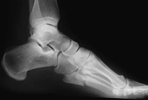 Foot & Ankle 2009 Practice Questions: Set 3 (Solved) - Figure 9