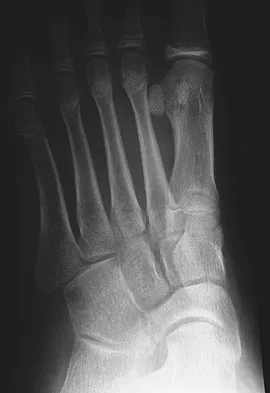 Foot & Ankle Board Review 2009: High-Yield MCQs (Set 4) - Figure 12