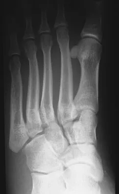 Foot & Ankle Board Review 2009: High-Yield MCQs (Set 4) - Figure 2