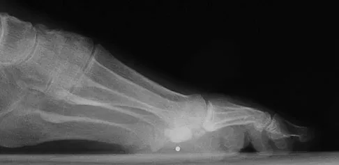 Foot & Ankle Board Review 2009: High-Yield MCQs (Set 4) - Figure 27