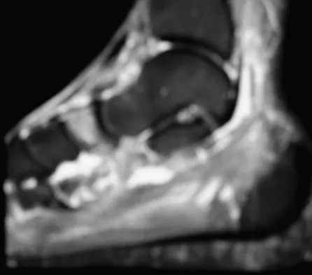 Foot & Ankle Board Review 2009: High-Yield MCQs (Set 4) - Figure 7